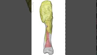 Animation of Centrosaurus Apertus Shin Bone With Malignant Bone Cancer [upl. by Znieh644]