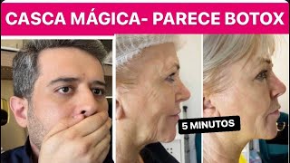 CASCA PODEROSA  10X MELHOR QUE BOTOX ESTICA AS RUGAS E CLAREIA MANCHAS EM 12 MINUTOS [upl. by Sitof]