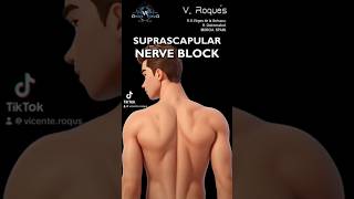 SUPRASCAPULAR NERVE BLOCK nerveblock nervepainrelief nerveblocks nervepaintreatment [upl. by Nnahsal]