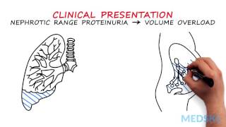 Nephrology – Proteinuria By Manish Suneja MD [upl. by Zoes]