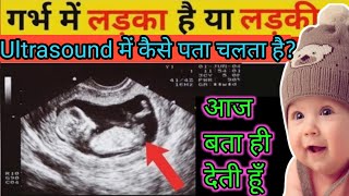 🤱डॉक्टर और विज्ञान भी इस को मानते हैं Pregnancy Ultrasound report se kaise Jane ladka hai ya ladki🥰 [upl. by Sliwa91]