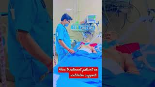 live treat patients on ventilator support ajeetsingh medical ki duniya short [upl. by Luzader]