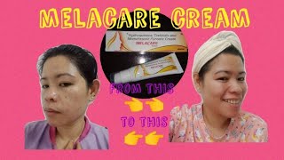 product review melacare productreview facecream [upl. by Hahnke335]