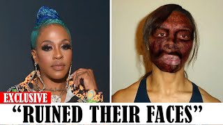 20 Black celebrities Who RUINED Their Careers With PLASTIC SURGERY [upl. by Relyt174]