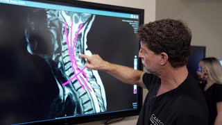 Symptoms of Cervical Stenosis  Jeffrey Cantor MD [upl. by Mur548]