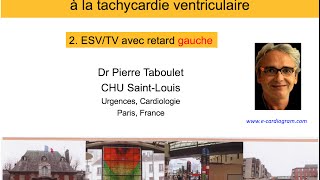 10b De lESV à la tachycardie ventriculaire Retard gauche P Taboulet [upl. by Nanji]