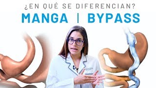 Diferencias entre Bypass Gástrico y Manga Gástrica  Clínicas Diego de León [upl. by Cotterell]