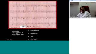 Pedicardio classes on ECG in arrhythmias with Quiz by Dr Ulhas Pandurangi [upl. by Chiou711]