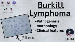 Burkitts Lymphoma  Non Hodgkins Lymphoma  Pathology [upl. by Ku]