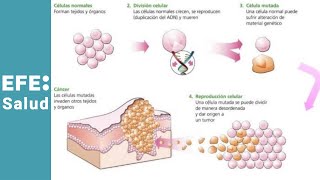 ¿Por qué se generan los cánceres de cabeza y cuello [upl. by Brenk258]