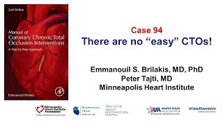 Case 94 Manual of CTO Interventions There are no quotsimplequot CTOs [upl. by Heer304]