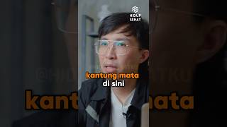 Menghilangkan kantung mata 😩  dr Tirta tipssehat tips doktertirta drtirta tipshidupsehat [upl. by Fonsie]