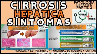 CIRROSIS HEPÁTICA SÍNTOMAS  GuiaMed [upl. by Livi234]