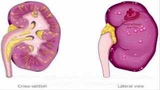 What is Pyelonephritis Symptoms Causes Treatments [upl. by Strait]