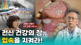 Full 겉으로 드러나지 않는 구강 질환 당신의 구강은 안녕하십니까ㅣ귀하신 몸ㅣ75화 전신 건강의 창 입속을 지켜라 [upl. by Moor683]