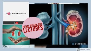 RENAL PATHOLOGY lecture 15a ACUTE KIDNEY INJURY important topic explanation [upl. by Kala]