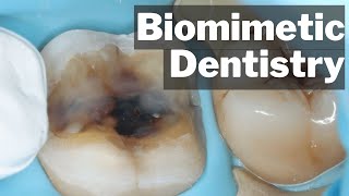 Biomimetic Dentistry  What Actually Is It  PDP135 [upl. by Inahet]