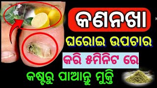 କଣନଖ ର ଘରୋଇ ଉପଚାରkana nakha treatment medicine odia gharoi upachar kana nakha hele kn kariba bn [upl. by Allison209]