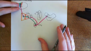 Huntingtons Disease and Huntington’s Disease Medications Part 7 [upl. by Adlitam]