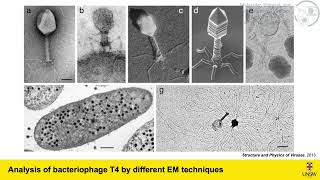 4 CryoElectron Microscopyof Viral ParticlesDLuque [upl. by Weiser392]