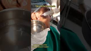 TMJ Arthrocentesis by Dr Hemant Baonerkar Maxillofacial Surgeon [upl. by Frye]