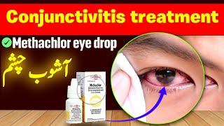 Methachlor eye drops  treatment of conjunctivitis [upl. by Clayborne]