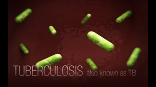 CDC Tuberculosis TB Transmission and Pathogenesis Video [upl. by Ferrel]