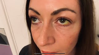 ASMR You’re an Ophthalmoscope [upl. by Bary]