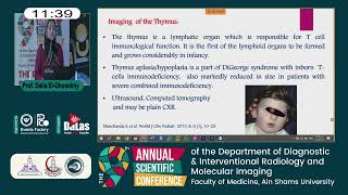 Phenotypic clues to inborn errors of immunity [upl. by Hama]