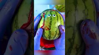 Emergency FruitSurgery Pineapple Triplets😱😩💔 FoodSurgery DiscountDentist Satisfying ASMR [upl. by Des911]