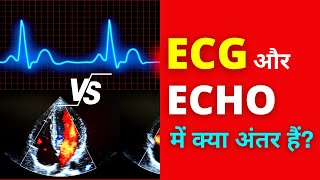 ECG vs ECHO Difference in Hindi  Heart Electrocardiograph vs Echocardiogram [upl. by Saimon]