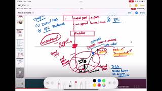 Brown sequard syndrome neurology 139  First Aid USMLE Step 1 in UrduHindi [upl. by Ateikan]