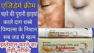 AZIDERM CREAM REVIEW चहरे के काले दाग धब्बे झाइयांएकने पिम्पल्स सब जड से खत्म करने की क्रीम [upl. by Cram]