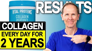 Vital Proteins Collagen Peptides  Results After 2 Years [upl. by Lyndsie]