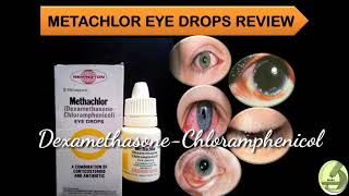 Metachlor Eye Drops Full Review  DexamethasoneChloramphenicol [upl. by Labina]