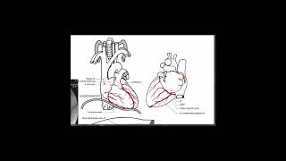 Artère coronaire droite [upl. by Alolomo84]
