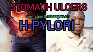 Stomach Ulcers Hpylori FORMATION and MANAGEMENT [upl. by Eeneg]