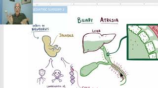 Paediatric surgery in Arabic 13  Biliary Atresia  by Dr Wahdan [upl. by Leelahk196]