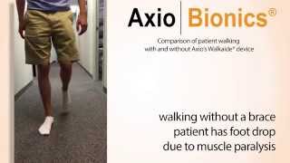 Axiobionics Walkaide® corrects foot drop [upl. by Salba271]