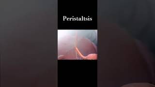 peristaltic movement [upl. by Kumar]