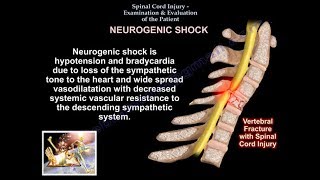 Spinal Cord injury  Examination amp Evaluation  Everything You Need To Know  Dr Nabil Ebraheim [upl. by Meluhs]