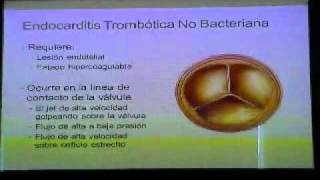 ENDOCARDITIS INFECCIOSA 2 [upl. by Richara]