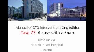 Case 77 Manual of CTO Interventions  Wire snaring and externalization [upl. by Anahsirk340]