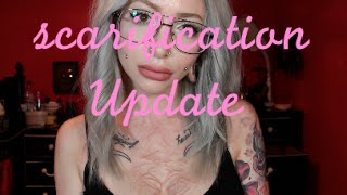 Scarification Gone Wrong 3yr Update [upl. by Naut]