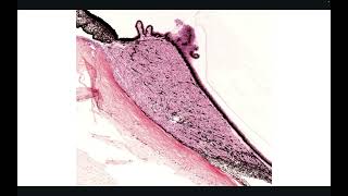 Histología del Ojo [upl. by Brunell]