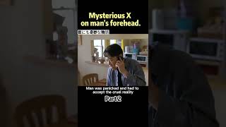 Man found a mysterious X Mark on his forehead [upl. by Ataeb]