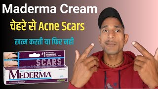 Maderma Advance Scar Gel Review  How To Use Maderma Cream  Maderma For Acne Scars [upl. by Maddi]