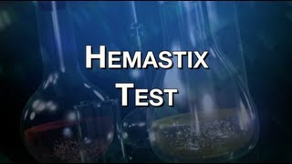 Hemastix Test [upl. by Naitsirhk129]