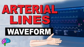 The Arterial Line Waveform EXPLAINED [upl. by Cassandra]