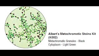 Alberts Stain Neissers stain for C diphtheria demo [upl. by Starlin388]